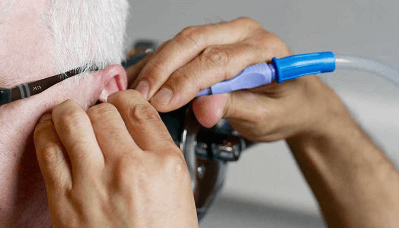 Microsuction Ear Wax Removal Microsuction Ear Wax Removal